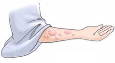 小满——未病先防，清热除湿正当时