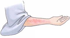 小满——未病先防，清热除湿正当时