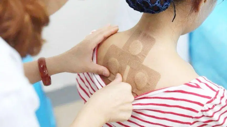 三伏贴使用方法