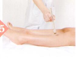 湿热体质的艾灸疗法