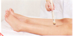 呕吐的艾灸疗法