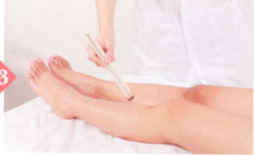 胃下垂的艾灸疗法