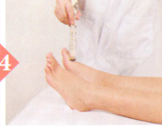 神经衰弱的艾灸疗法