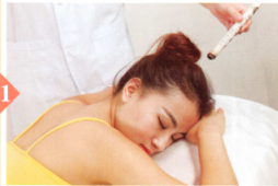 眩晕的艾灸疗法