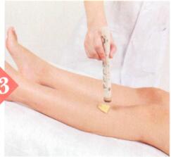 黄褐斑的艾灸疗法