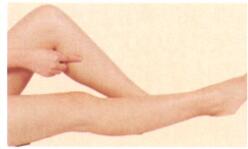 白癜风的艾灸疗法