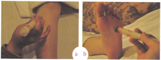 低血压的艾灸疗法