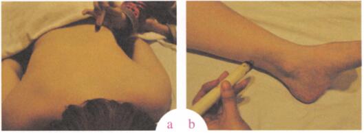 白带病的艾灸疗法