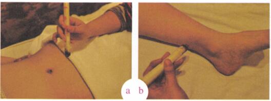 白带病的艾灸疗法