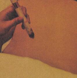 白带病的艾灸疗法