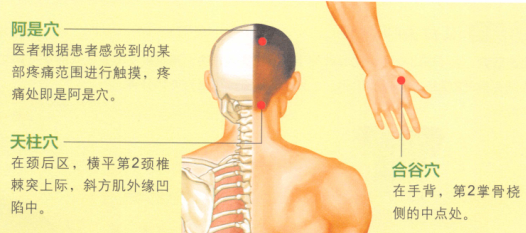 头痛的艾灸疗法