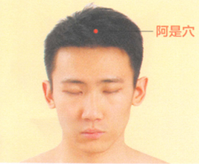 头痛的艾灸疗法