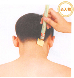 头痛的艾灸疗法