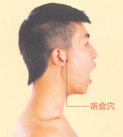 耳鸣-耳聋的艾灸疗法