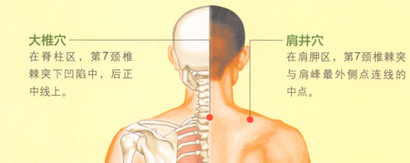颈椎病的艾灸疗法