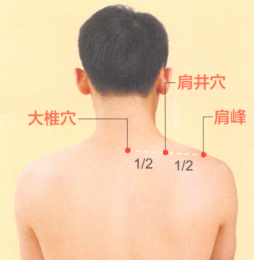 颈椎病的艾灸疗法