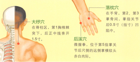 落枕的艾灸疗法