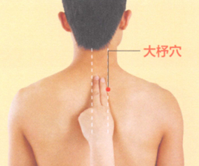 落枕的艾灸疗法