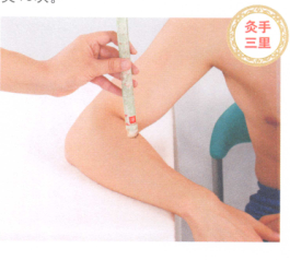 肘关节痛的艾灸疗法