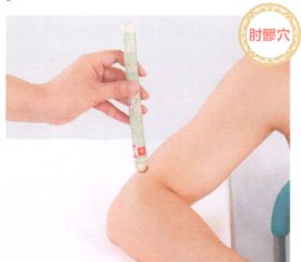 肘关节痛的艾灸疗法