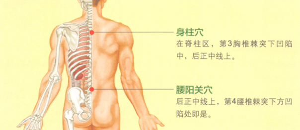 背脊痛的艾灸疗法