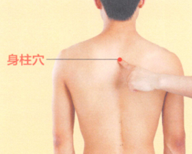背脊痛的艾灸疗法