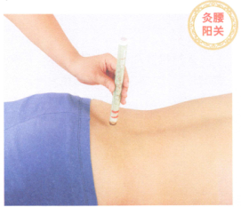 腰间盘突出症的艾灸疗法