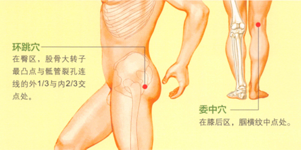 坐骨神经痛的艾灸疗法
