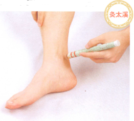 足跟痛的艾灸疗法