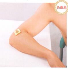 风湿性关节炎的艾灸疗法