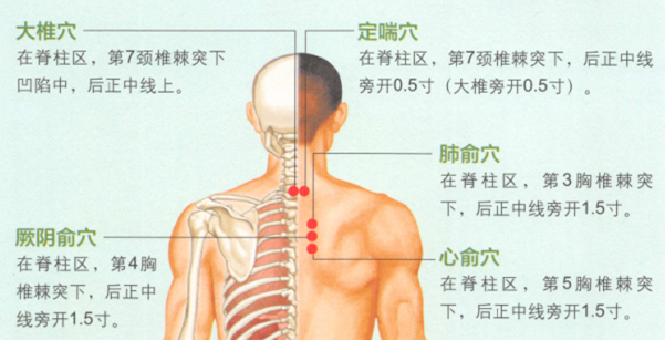 慢性支气管炎的艾灸疗法