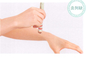 哮喘的艾灸疗法