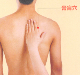 哮喘的艾灸疗法