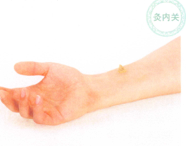 冠心病的艾灸疗法