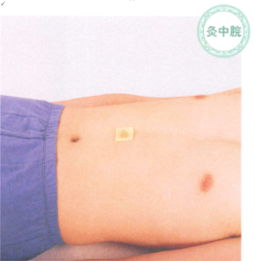 慢性胃炎的艾灸疗法