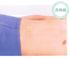 慢性胃炎的艾灸疗法