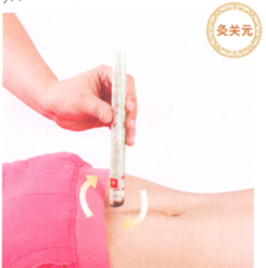 痛经的艾灸疗法