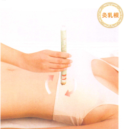 产后缺乳的艾灸疗法