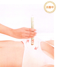 产后缺乳的艾灸疗法