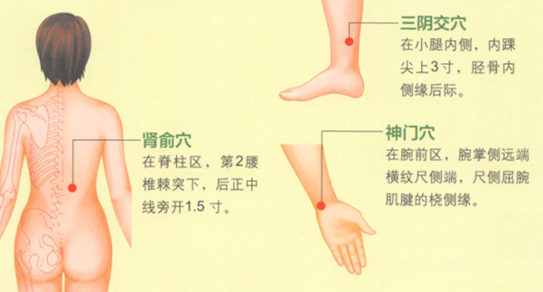 更年期综合征的艾灸疗法