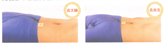 益肾温阳艾灸调理方的艾灸疗法