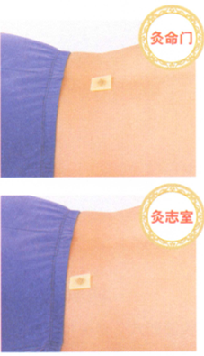 益肾温阳艾灸调理方的艾灸疗法