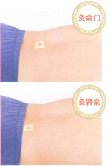 慢性前列腺炎的艾灸疗法