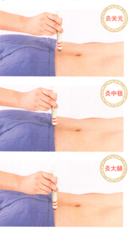 不育症的艾灸疗法