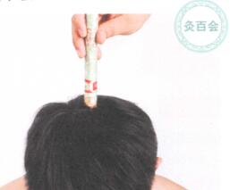 冬季艾灸的艾灸疗法