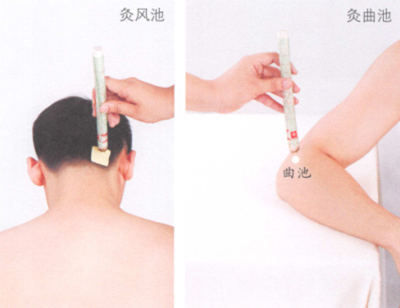 高血压病的艾灸疗法