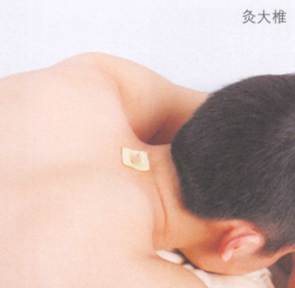 哮喘的艾灸疗法