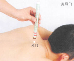 慢性支气管炎的艾灸疗法