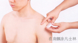 中风后遗症的艾灸疗法