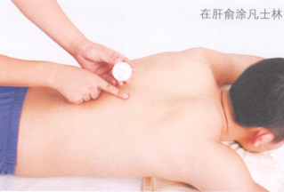 肝硬化的艾灸疗法